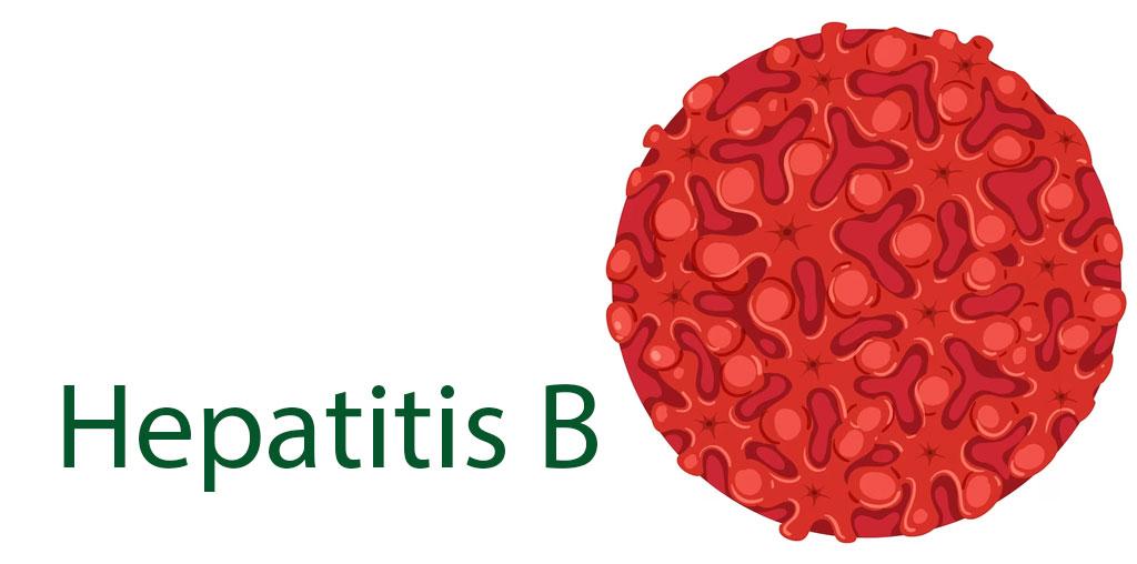 هپاتیت B و علائم آن - شرکت درمان نگار آیندگان