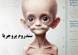 پیری زودرس یا پروجریا - شرکت درمان نگار آیندگان