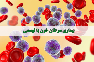 بیماری سرطان خون یا لوسمی - شرکت درمان نگار آیندگان