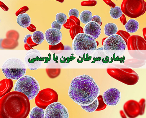 بیماری سرطان خون یا لوسمی - شرکت درمان نگار آیندگان