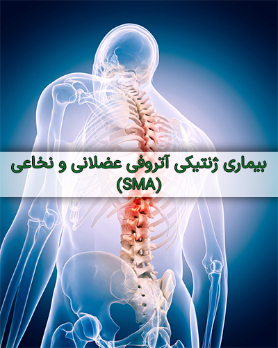 بیماری SMA - درمان نگار آیندگان