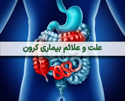 علائم-بیماری-کورن